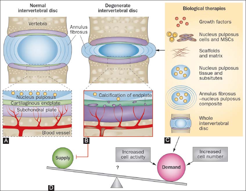 intervertebral disc structure