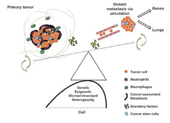 Cancer metastasis - tricks of the trade