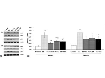 The effect of metformin treatment on endoplasmic reticulum (ER) stress induced by status epilepticus (SE) via the PERK-eIF2α-CHOP pathway