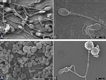 Adapted methods for scanning electron microscopy (SEM) in assessment of human sperm morphology