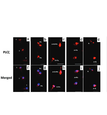 Oligoasthenoteratozoospermic (OAT) men display altered phospholipase C ζ (PLCζ) localization and a lower percentage of sperm cells expressing PLCζ and post-acrosomal sheath WW domain-binding protein (PAWP)
