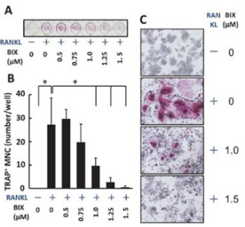 BIX01294 suppresses osteoclast differentiation on mouse macrophage-like Raw264.7 cells