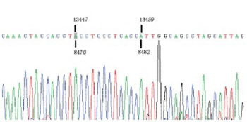 Mitochondrial DNA 4977 bp deletion is a common phenomenon in hair and increases with age