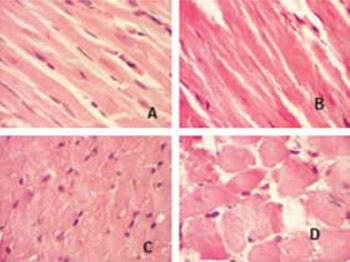 Heart-type fatty acid-binding protein and its relation with morphological changes in rat myocardial damage model induced by isoproterenol