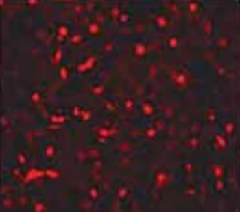 Sonoporation using microbubbles promotes lipofectamine -mediated siRNA transduction to rat retina.
