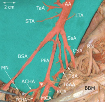Vascular patterns of upper limb: an anatomical study with accent on superficial brachial artery