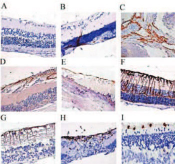 A Immunohistochemical Analysis of a Rat Model of Proliferative Vitreoretinopathy and a Comparison of the Expression of Tgf-Β and PDGF Among the Induction Methods