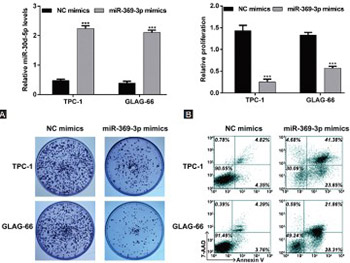 Downregulation of TSPAN13 by miR-369-3p inhibits cell proliferation in papillary thyroid cancer (PTC)