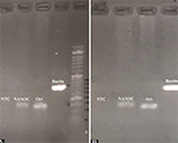 Human amniotic fluid stem cells (hAFSCs) expressing p21 and cyclin D1 genes retain excellent viability after freezing with (dimethyl sulfoxide) DMSO