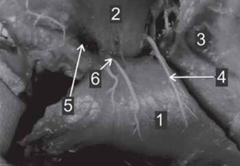 Vascularisation of Pectoralis Maior Myocutaneous Flap - Anatomical Study in Human Fetuses and Cadavers