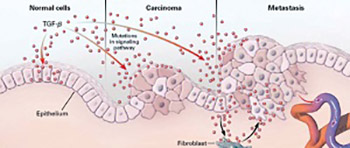 The Role of the Stroma in Carcinogenesis