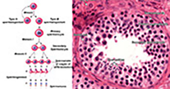 MicroRNAs: Recent insights towards their role in male infertility and reproductive cancers