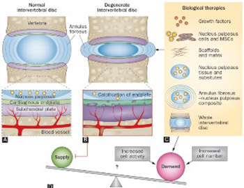 Intervertebral disc tissue engineering: A brief review