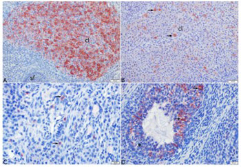 Expression of the anti-Mullerian hormone, kisspeptin 1, and kisspeptin 1 receptor in polycystic ovary syndrome and controlled ovarian stimulation rat models