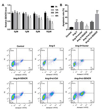 LncRNA SENCR suppresses abdominal aortic aneurysm formation by inhibiting smooth muscle cells apoptosis and extracellular matrix degradation