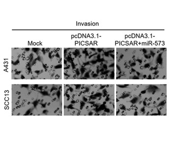 MicroRNA-573 inhibits cell proliferation, migration and invasion and is downregulated by PICSAR in cutaneous squamous cell carcinoma