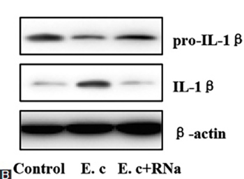 Nod-like receptor protein 3 inflammasome activation by Escherichia coli RNA induces transforming growth factor beta 1 secretion in hepatic stellate cells