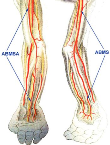 Brachiomedian artery (arteria brachiomediana) revisited: a comprehensive review