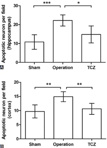 Tocilizumab inhibits neuronal cell apoptosis and activates STAT3 in cerebral infarction rat model