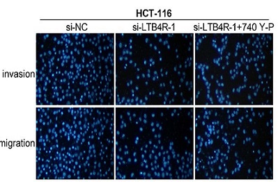 Leukotriene B4 receptor knockdown affects PI3K/AKT/mTOR signaling and apoptotic responses in colorectal cancer