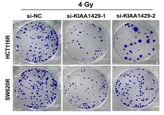 Role and mechanism of KIAA1429 in regulating cellular ferroptosis and radioresistance in colorectal cancer