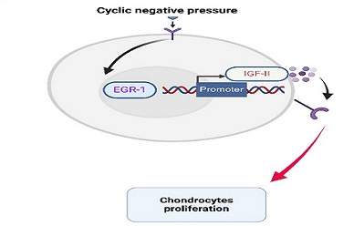 Cyclic negative pressure promotes chondrocyte growth: Association of IGF-II with EGR-1
