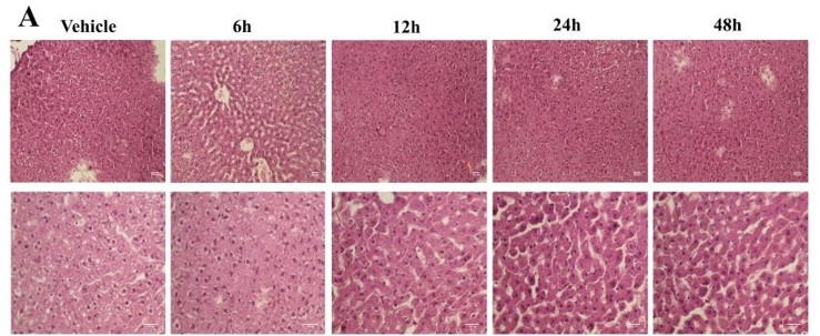 Long non-coding RNA (lncRNA) cancer susceptibility candidate 7 (CASC7) contributes to the progression of lipopolysaccharide (LPS)-induced liver injury by targeting microRNA-217(miR217)/toll-like receptor 4 (TLR4) axis