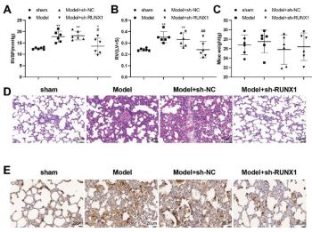 Inhibition of RUNX1 slows the progression of pulmonary hypertension by targeting CBX5