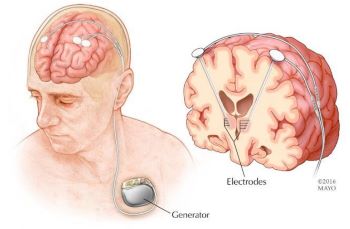 Neuromodulation guide for the non-neuromodulator clinician: What it is and how it can benefit patients?