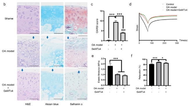 Piezo1-driven mechanotransduction as a key regulator of cartilage degradation in early osteoarthritis