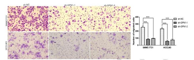 Comprehensive analysis of GPN1 in human cancer and its effects on the migration of hepatocellular carcinoma cells