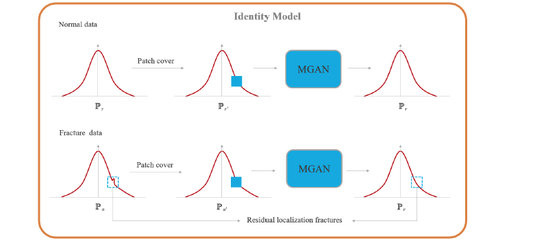 Deep learning approach based on a patch residual for pediatric supracondylar subtle fracture detection