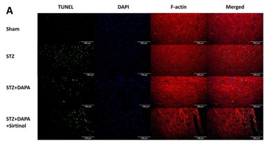 Dapagliflozin and Sirtuin-1 interaction and mechanism for ameliorating atrial fibrillation in a streptozotocin-induced rodent diabetic model