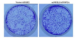 NEIL3 and TOP2A as key drivers of esophageal cancer through WNT signaling