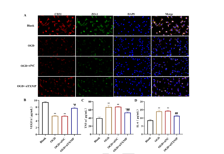 Targeting TXNIP for neuroprotection: A novel approach to reducing inflammation and promoting recovery in ischemic stroke