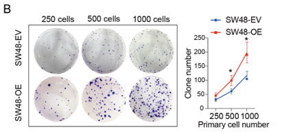 Multi-omics reveals that ST6GAL1 promotes colorectal cancer progression through LGALS3BP sialylation