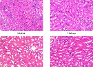 The α7 nicotinic acetylcholine receptor agonist PNU-282987 ameliorates sepsis-induced acute kidney injury through CD4
