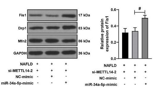 Silencing METTL14 alleviates liver injury in non-alcoholic fatty liver disease by regulating mitochondrial homeostasis