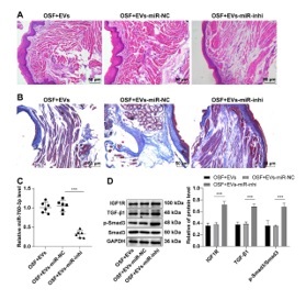 Adipose tissue-derived stromal cell-extracellular vesicles ameliorate oral submucous fibrosis by blocking the TGF-β1/Smad3 pathway via the miR-760-3p/IGF1R axis